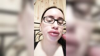 Post-fillers lips fetish