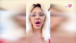 Most excellent of Huge fake Lips on the World June 2024 - Vienna Xtreme