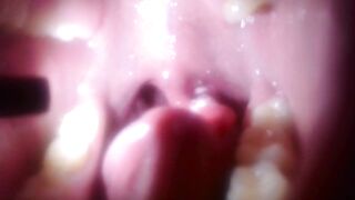 I Swallows a petite ball, a dolls arm and a vibrator