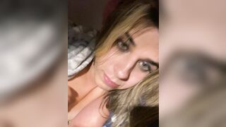 Petite transgender breasts two+yearsHRT [with Pectus carinatum chest]