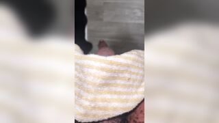 Ebony Transman FTM Phalloplasty