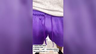 Ebony transman abdominal flap Phalloplasty