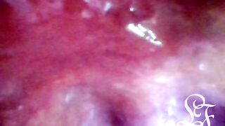 POV Bizarre Unfathomable Anal Exploration! Fast visible Heartbeat ????