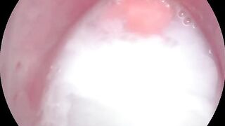 How is this close up looking?