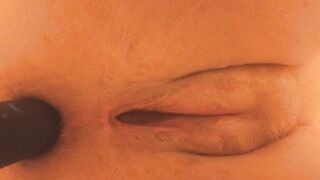 Post op, cum trickling