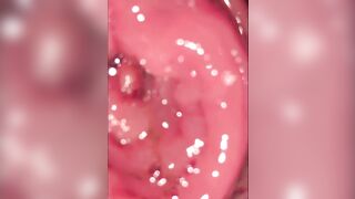 Midnight exhibition at restroom with vagina gape twenty-Mar-2021